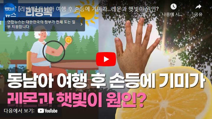 [연합뉴스]동남아 여행 후 손등에 기미가…레몬과 햇빛이 원인?